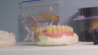 Diş modellerinin yan görüntüsü beyaz bir yüzeye dayanır, eğitici veya klinik referans için detaylı dişler ve sakız yapıları sergilenir. Bir tanesinde mor bir işaret var..