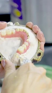 Yakın plan çekimde, diş kalıbının üst kısmında takma dişler ve pembe sakız tabanlı takma dişler var..