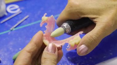Pembe, esnek, kısmi protezin yüzeyini pürüzsüz hale getirmek için döner cilalayıcı kullanan bir diş teknisyeninin yakın çekimi..