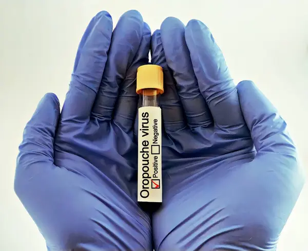 stock image scientist with Oropouche virus positive blood sample. Medical laboratory