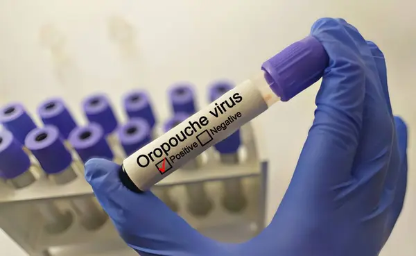 stock image scientist with Oropouche virus positive blood sample. Medical laboratory