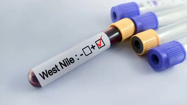 stock image West Nile positive blood sample. Blood sample for West Nile virus testing