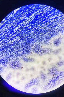 Ziehl-Neelson Mycobacterium türlerinin mikroskobik morfolojisi.