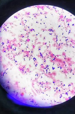 Gram positive cocci bacteria in gram staining, Gram positive diplococci, Microbiology lab clipart