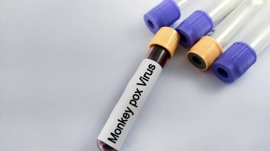 Blood sample tube for Monkeypox virus test. Monkeypox infection pandemic. Monkeypox infected blood sample. clipart