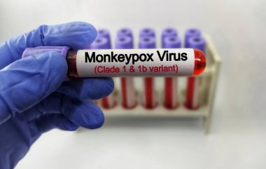 Maymun çiçeği virüsü (MPXV) testi için kan testi. Mpox (Maymun Çiçeği olarak da bilinir), Maymun Çiçeği virüsü olarak bilinen virüsün yol açtığı bir hastalıktır. zoonotik hastalıklar.