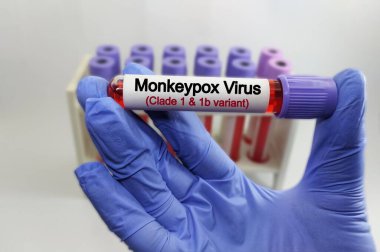 Maymun çiçeği virüsü (MPXV) testi için kan testi. Mpox (Maymun Çiçeği olarak da bilinir), Maymun Çiçeği virüsü olarak bilinen virüsün yol açtığı bir hastalıktır. zoonotik hastalıklar.