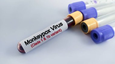Mpox (maymun çiçeği) için kan örneği 1. ve 1b varyant testi.