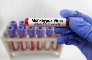 Maymun çiçeği virüsü (MPXV) testi için kan testi. Mpox (Maymun Çiçeği olarak da bilinir), Maymun Çiçeği virüsü olarak bilinen virüsün yol açtığı bir hastalıktır. zoonotik hastalıklar.