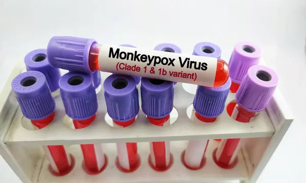 stock image Blood sample for MPox (monkeypox) Clade 1 and 1b variant test.