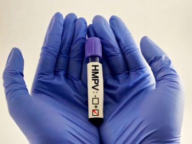İnsan Metapneumovirüsü (HMPV) pozitif test, Tıbbi Sağlık Konsepti
