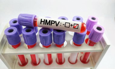 İnsan Metapneumovirüsü (HMPV) pozitif test, Tıbbi Sağlık 