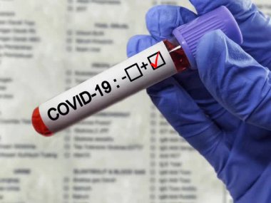 Coronavirus Covid 19 numune tüpünde enfekte kan örneği