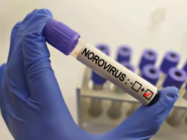 Norovirüslü kan örneği pozitif.