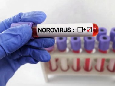 Norovirüslü kan örneği pozitif.
