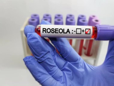 Roseola için kan örnekleri tutan bilim adamı (Exanthem altbitum).