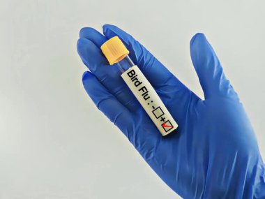 Kuş gribi pozitif kan örneği