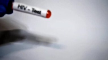 HIV AIDS virüsü kan testi tüpü yakın çekim, kan toplama tüpleri HIV testi pozitif sonuçlar, tıbbi sağlık konsepti