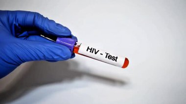 Mavi eldiven giyen doktor bir klinikte üzerinde HIV yazan bir kan testi tüpü tutuyor.,