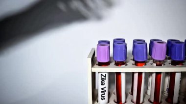Biyokimyacı veya laboratuvar teknisyeni Zika virüsü testi için kan örnekleri tutuyor.