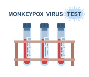 Maymun çiçeği virüsü. Maymun çiçeği virüsünün tespiti için test edin. Test tüpleri pozitif ve negatif sonuç veriyor. Maymun çiçeği virüsü salgını.