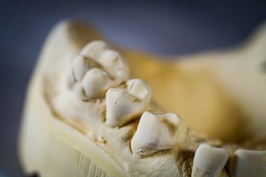 Tıbbi bir diş izinin nesne görüntüsü