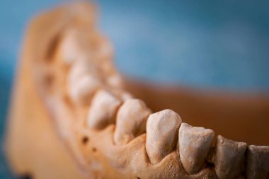 Tıbbi bir diş izinin nesne görüntüsü