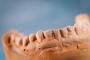 Tıbbi bir diş izinin nesne görüntüsü