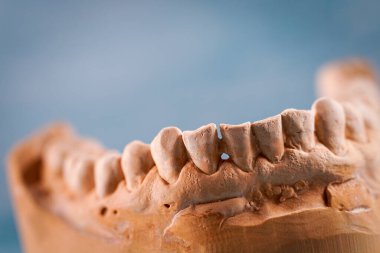 Tıbbi bir diş izinin nesne görüntüsü