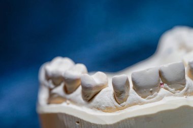 Tıbbi bir diş izinin nesne görüntüsü