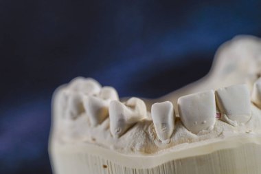 Tıbbi bir diş izinin nesne görüntüsü