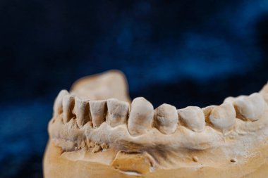 Tıbbi bir diş izinin nesne görüntüsü