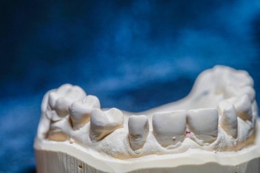 Tıbbi bir diş izinin nesne görüntüsü