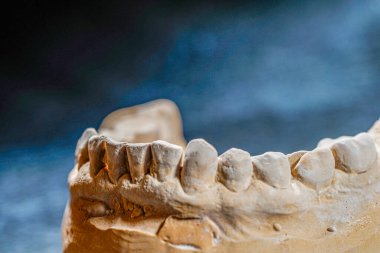 Tıbbi bir diş izinin nesne görüntüsü