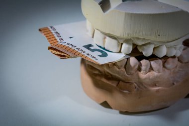 Avrupa para birimi banknotları ile tıbbi diş izinin nesne görüntüsü