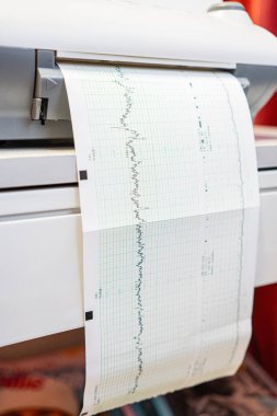 Tıbbi grafik çıktısı üreten bir tanı makinesinin detaylı görünümü, klinik bir ortamda sağlık analizi ve veri sunum teknolojisinin gösterimi.