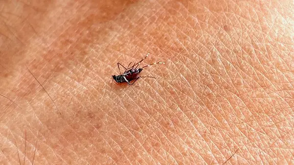 Bir sivrisinek, muhtemelen Aedes aegypti veya Aedes albopictus, siyah ve beyaz çizgili bacakları ve gövdesini gösteren bir elin üzerinde durmaktadır.