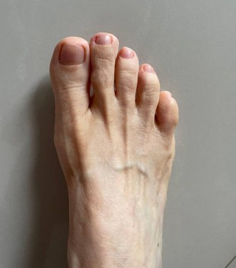 Açık gri arka planda ayak parmaklarının anatomisini gösteren insan ayağının detaylı bir görüntüsü. Cilt doğal dokuyu gösteriyor ve bakımlı tırnaklar kişisel bakım ve sağlığı yansıtıyor. Yumuşak ışıklandırma ayak parmaklarının narin şekillerini vurgular, Sy.