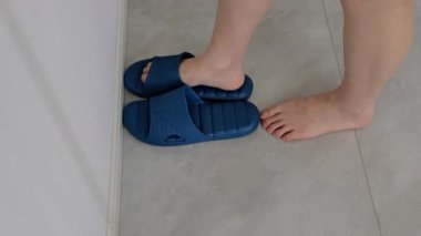 Ev Terlikleri 'nde Onychomycosis ile Ayaklar