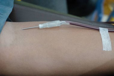 Kan bağışı faaliyetlerinde kateter yoluyla ellerden kan toplama işlemi