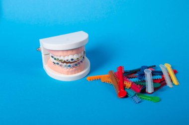 Renkli ortodontik bağlar, tedavi sırasında düzgün diş hizalanması ve istikrarın sağlanması için, parantezlere kemer telleri yerleştirmek üzere tasarlandı..