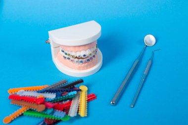 Renkli ortodontik bağlar, tedavi sırasında düzgün diş hizalanması ve istikrarın sağlanması için, parantezlere kemer telleri yerleştirmek üzere tasarlandı..