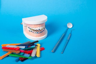 Renkli ortodontik bağlar, tedavi sırasında düzgün diş hizalanması ve istikrarın sağlanması için, parantezlere kemer telleri yerleştirmek üzere tasarlandı..