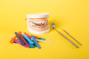 Diş muayenehanesindeki hastanın ellerinde renkli ortodontik bağlar var. Diş telleri için parlak renkli lastikler. Ön manzara. Boşluğu Kopyala.