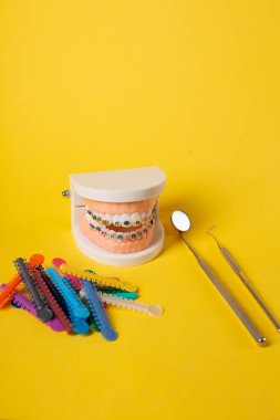 Diş muayenehanesindeki hastanın ellerinde renkli ortodontik bağlar var. Diş telleri için parlak renkli lastikler. Ön manzara. Boşluğu Kopyala.