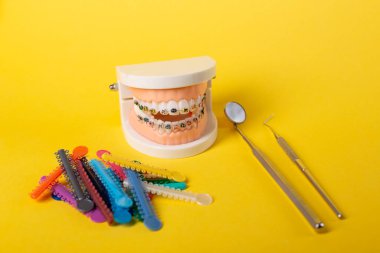 Diş muayenehanesindeki hastanın ellerinde renkli ortodontik bağlar var. Diş telleri için parlak renkli lastikler. Ön manzara. Boşluğu Kopyala.