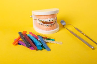 Diş muayenehanesindeki hastanın ellerinde renkli ortodontik bağlar var. Diş telleri için parlak renkli lastikler. Ön manzara. Boşluğu Kopyala.