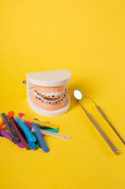 Diş muayenehanesindeki hastanın ellerinde renkli ortodontik bağlar var. Diş telleri için parlak renkli lastikler. Ön manzara. Boşluğu Kopyala.