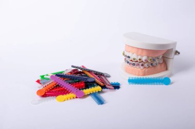 Beyaz arkaplanda izole edilmiş diş telleri ile çene modeli.