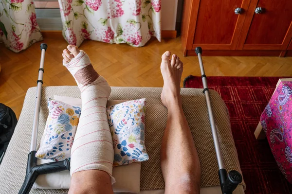 Fractured Foot Bandage Made Doctor — Stock Photo, Image